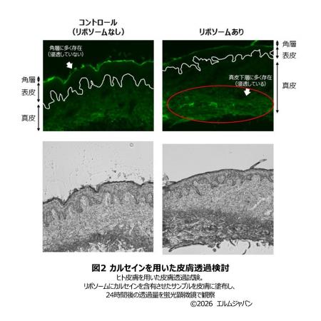 多重層リポソームを基盤とした経皮吸収技術の開発 多重層リポソームを基盤とした経皮吸収技術の開発