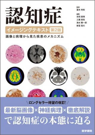 認知症の本態に迫る!書籍『認知症イメージングテキス 認知症の本態に迫る!書籍『認知症イメージングテキス
