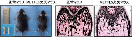 RNA修飾酵素METTL5が骨形成を支えるしくみを解明~国 RNA修飾酵素METTL5が骨形成を支えるしくみを解明~国