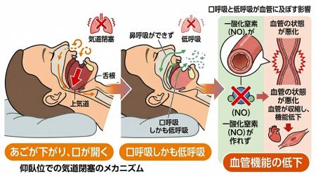 睡眠中の呼吸が“血管の働き”に与える影響──体内環境の 睡眠中の呼吸が“血管の働き”に与える影響──体内環境の