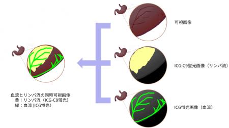 世界初「2種類のICG蛍光で複数の生体情報をリアルタイ