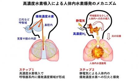 高濃度水素吸入器の着火実験と人体内水素爆発事故｜Mi