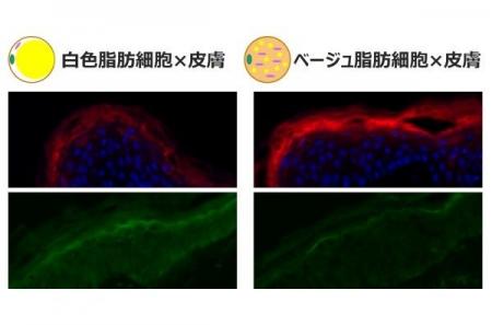 エネルギーを燃やす「ベージュ脂肪細胞」が肌のバリア エネルギーを燃やす「ベージュ脂肪細胞」が肌のバリア