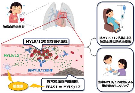 難治性疾患「肺高血圧症」の新たな治療標的を同定~血 難治性疾患「肺高血圧症」の新たな治療標的を同定~血