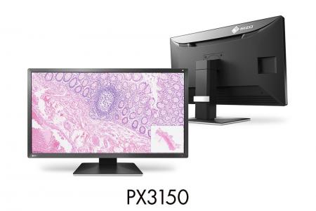 EIZO、デジタル化が進む病理分野に向け、初の病理専用 EIZO、デジタル化が進む病理分野に向け、初の病理専用
