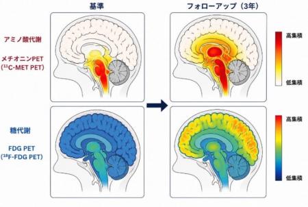 重症脳損傷後の意識回復では脳幹アミノ酸代謝が活発に 重症脳損傷後の意識回復では脳幹アミノ酸代謝が活発に