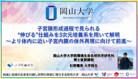 【岡山大学】子宮腺形成過程で見られる“伸びる”仕組み
