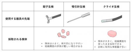 従来の生検法では診断が難しい肺の末梢病変に対するク