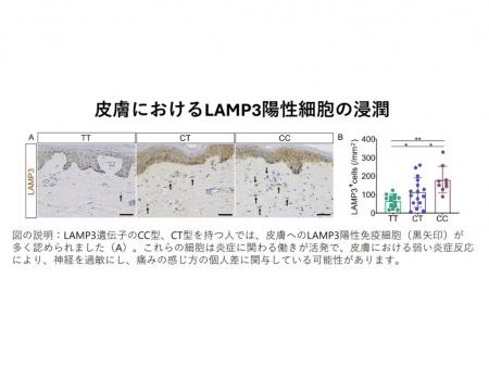 弘前大学大学院医学研究科の研究グループが岩木utf-8