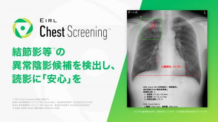 胸部X線診断支援AI「EIRL Chest Screening」を大幅ア 胸部X線診断支援AI「EIRL Chest Screening」を大幅ア