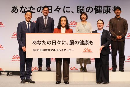 「脳が喜ぶ瞬間」は特別な出来事ではなかった　全国か