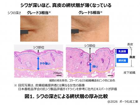 シワが刻まれにくい“しなやかな真皮”に修復する鍵を発 シワが刻まれにくい“しなやかな真皮”に修復する鍵を発