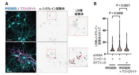 アストロサイトがパーキンソン病病理の進展を促utf-8