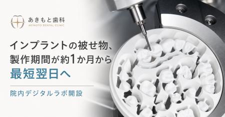 インプラントの被せ物、製作期間が約1か月から最短翌
