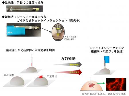 当社のジェットインジェクション技術を用いた腫瘍内ド