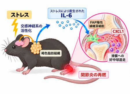 精神的ストレスが関節炎を再燃させる仕組みを解明―神