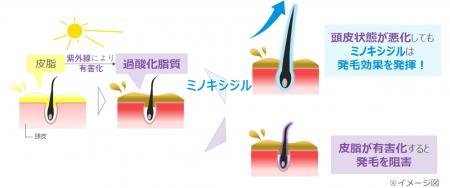 過酸化皮質が多い皮膚でのミノキシジル発毛作用を実証