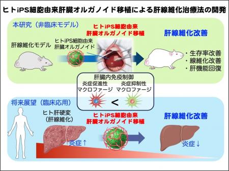 ヒトiPS細胞由来の肝臓オルガノイド移植による革utf-8