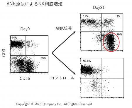 ANK療法はATLの第一治療として大きな可能性を示utf-8