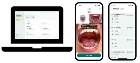 アイリスとアサヒグループが口腔状態評価アプリ『クチ