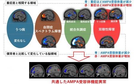 “脳を見える化” 複数の精神疾患で共通する異常をutf-8