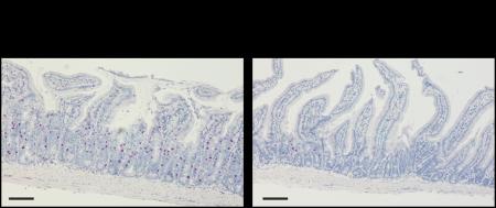 食物アレルギー症状の悪化に関わる新規メカニズムの解