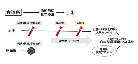 【慶應義塾】手術前の血液中から食道癌の予後を予測で