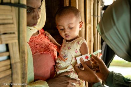 ロヒンギャ難民キャンプ 重度急性栄養不良の子ども27