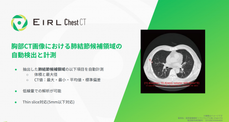 胸部CT画像から「肺がん」が疑われる肺結節候補域の検