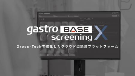 【新製品】がん見逃しゼロを目指すAIメディカルサービ