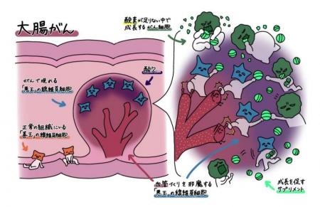 【大阪大学】部分的な酸欠状態が、大腸がんを悪utf-8