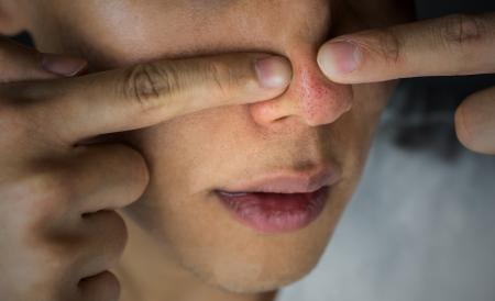 ■【男性9,419名の調査で判明】「毛穴」に悩む男性多数