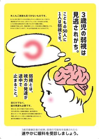 6月10日は『こどもの目の日』モスバーガーで弱視早期