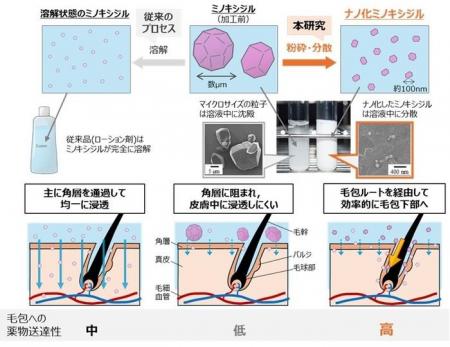 ナノ化ミノキシジルによる早い発毛効果とそのメutf-8