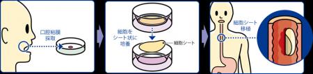多摩北部医療センターで再生医療を開始