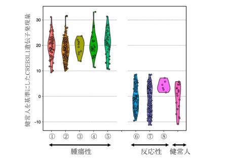 血液がんの新規バイオマーカーを実用化 血液がんの新規バイオマーカーを実用化