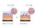 まずは1週間。肌を整えるための水光注射インスパイア まずは1週間。肌を整えるための水光注射インスパイア