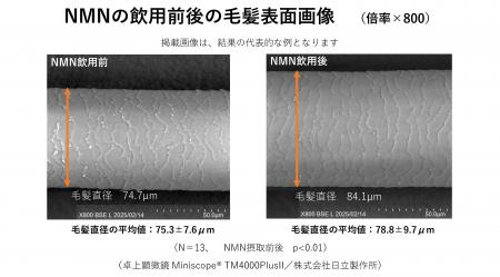 NMNの経口摂取が毛髪に及ぼす影響に関する臨床試験を NMNの経口摂取が毛髪に及ぼす影響に関する臨床試験を