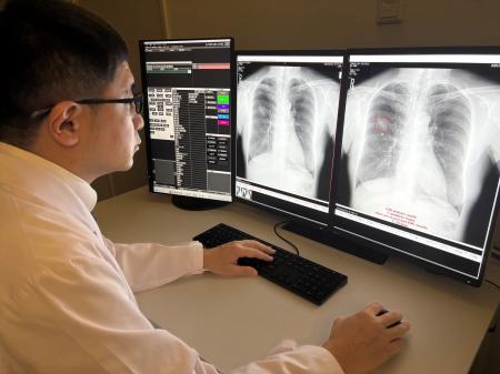 大日本印刷と横浜市立大学 AIを活用した肺がんスクリ 大日本印刷と横浜市立大学 AIを活用した肺がんスクリ