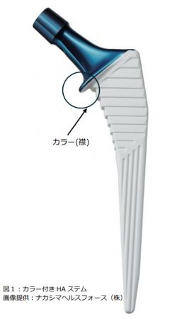 人工股関節全置換術後の骨折予防に新展開?-カラー(襟 人工股関節全置換術後の骨折予防に新展開?-カラー(襟