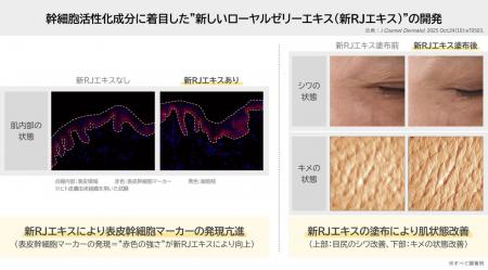 ローヤルゼリーに新知見 肌の角層水分量と真皮の厚み ローヤルゼリーに新知見 肌の角層水分量と真皮の厚み