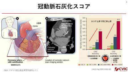 米国心臓病学会「冠動脈石灰化スコア」の重要性を正式 米国心臓病学会「冠動脈石灰化スコア」の重要性を正式