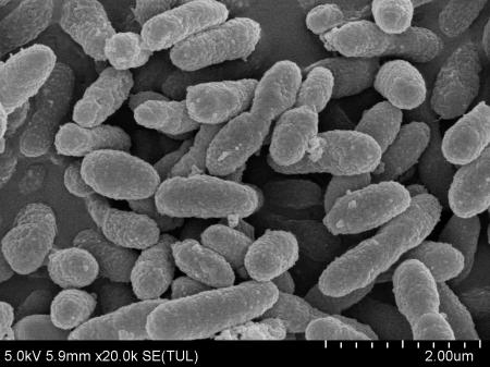 ヒト腸管由来のアッカーマンシア菌 「AKK PROBIO(R)」 ヒト腸管由来のアッカーマンシア菌 「AKK PROBIO(R)」