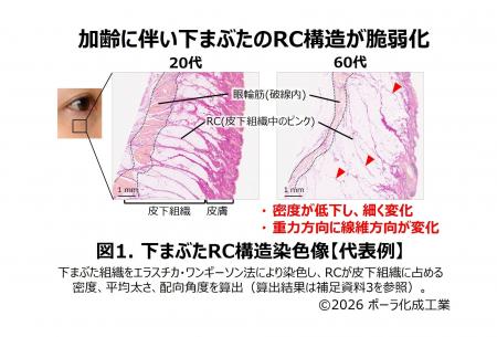 加齢で目立つ“目袋”に繋がる「下まぶたの構造変化」を 加齢で目立つ“目袋”に繋がる「下まぶたの構造変化」を