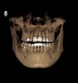 フェイススキャン・iTero・3D CTで「見える矯正」を実 フェイススキャン・iTero・3D CTで「見える矯正」を実