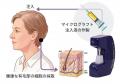 自家細胞を用いた新しい薄毛治療「マイクログラフト薄 自家細胞を用いた新しい薄毛治療「マイクログラフト薄