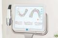 通わないマウスピース矯正「Oh my teeth」導入クリニ 通わないマウスピース矯正「Oh my teeth」導入クリニ