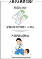 【9/1は大腸がん検診の日※1】早期発見が重要な大腸が 【9/1は大腸がん検診の日※1】早期発見が重要な大腸が