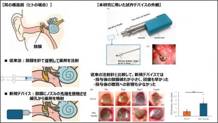 当社の針なしジェットインジェクション技術を用いた内 当社の針なしジェットインジェクション技術を用いた内
