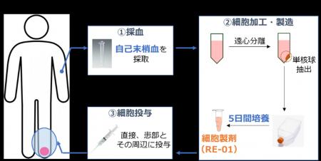 バージャー病、膠原病により生じる難治性虚血性下肢潰 バージャー病、膠原病により生じる難治性虚血性下肢潰